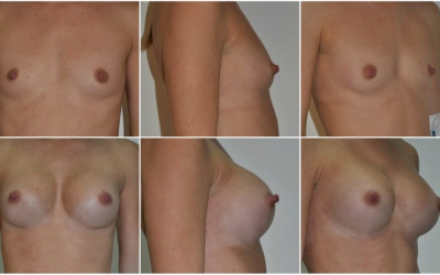 Anatomické 300 Anatomické 300