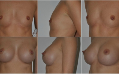 Anatomické 305 Anatomické 305