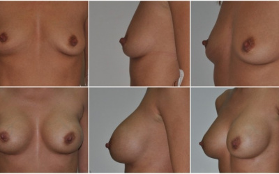 Anatomické 305 Anatomické 305