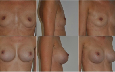 Anatomické 370 Anatomické 370