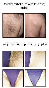 Koľko opakovní je potrebných