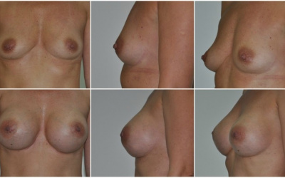 Okrúhle 330 Okrúhle 330