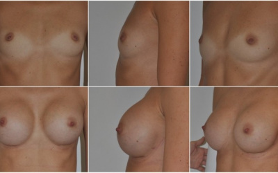 Okrúhle 330 Okrúhle 330