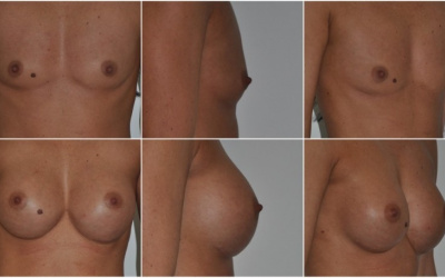 Okrúhle 360 Okrúhle 360