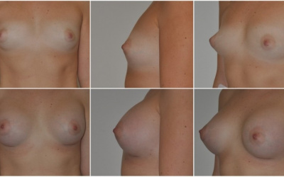 Okrúhle 360 Okrúhle 360