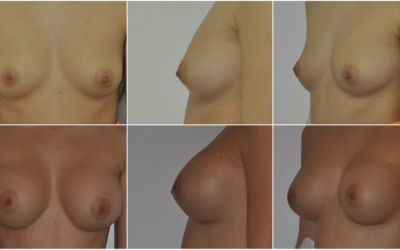 Okrúhle 390 Okrúhle 390