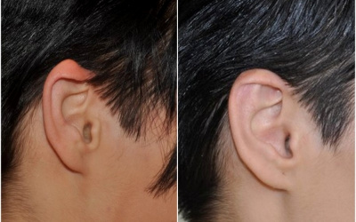 Vrodená deformita Vrodená deformita