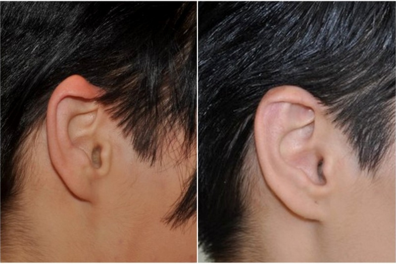 Vrodená deformita Vrodená deformita