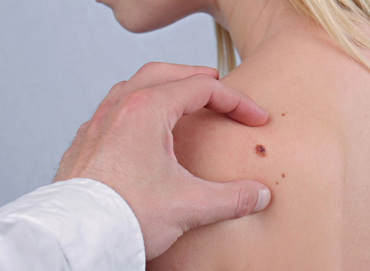 Zatrhnuté znamienko